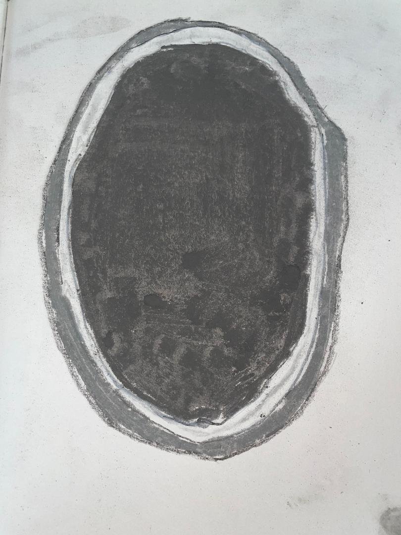 Dyke-Davidoff-Masson syndrome