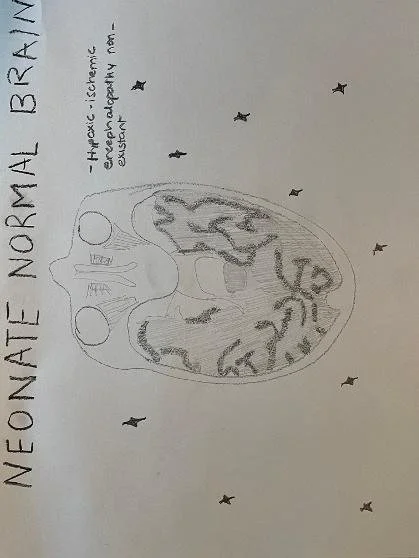 Neonate normal brain 
