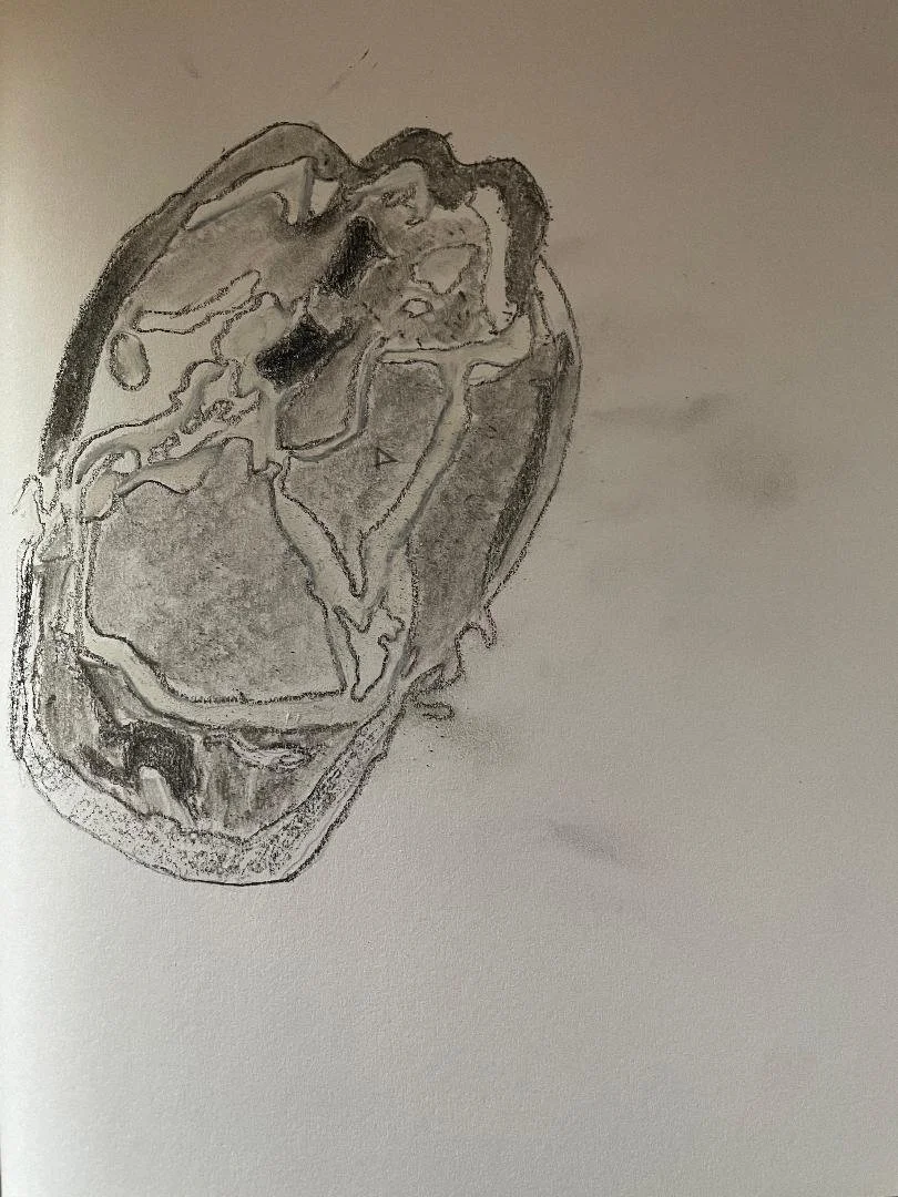 Penetrating craniofacial gunshot wound with tooth in the orbit