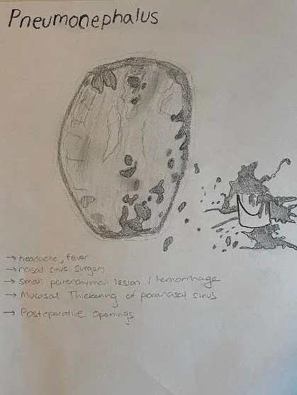 Pneumonephalus