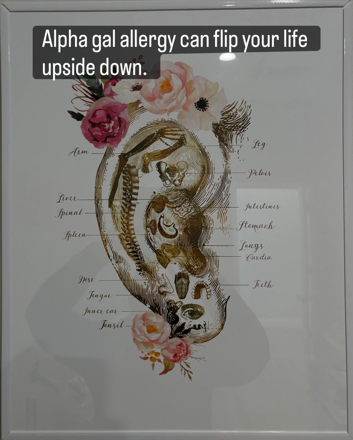 Having alpha gal allergy is a club no one wants to be in-but you do have options. 

#alphagal #vineandnj #vinelandacupuncture #southjersey #njoutdoors