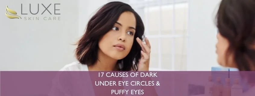 17 Causes of Dark Circles and Puffy Lids