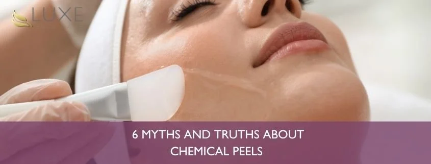 Peels: 6 myths and truths about chemical peels