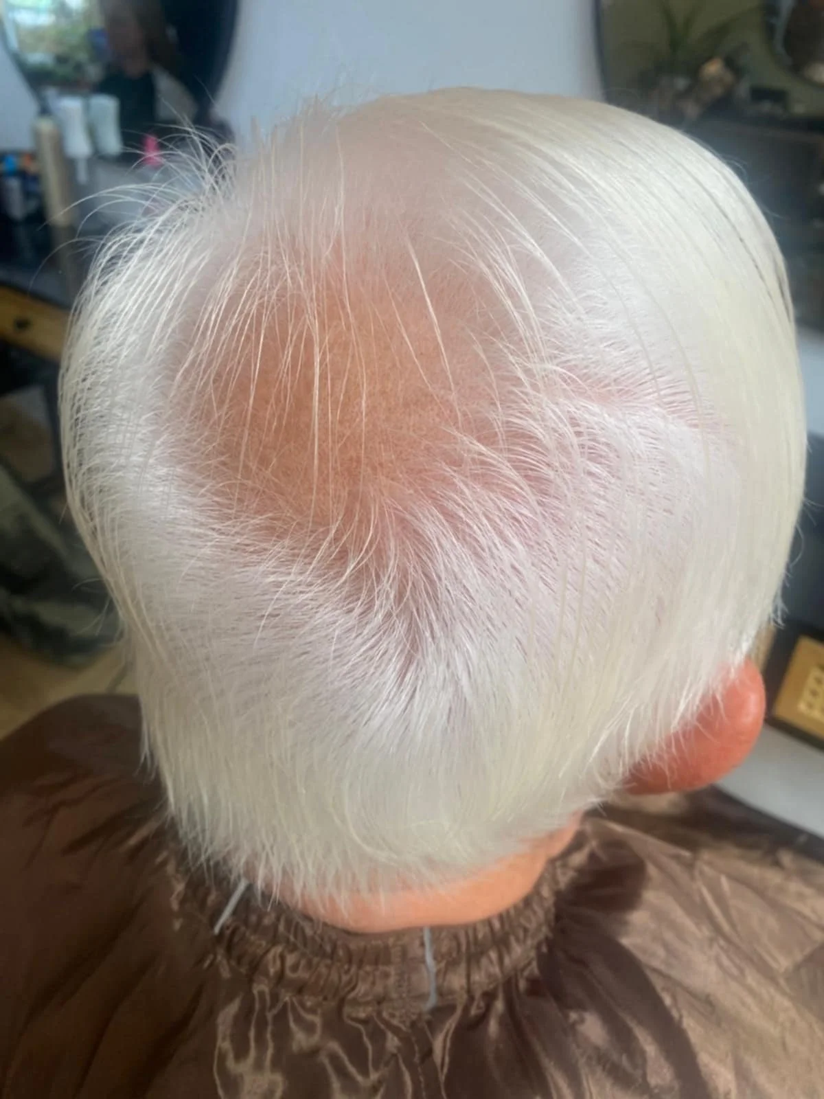 Hair Thinning Saxmundham Wickham Market.jpeg
