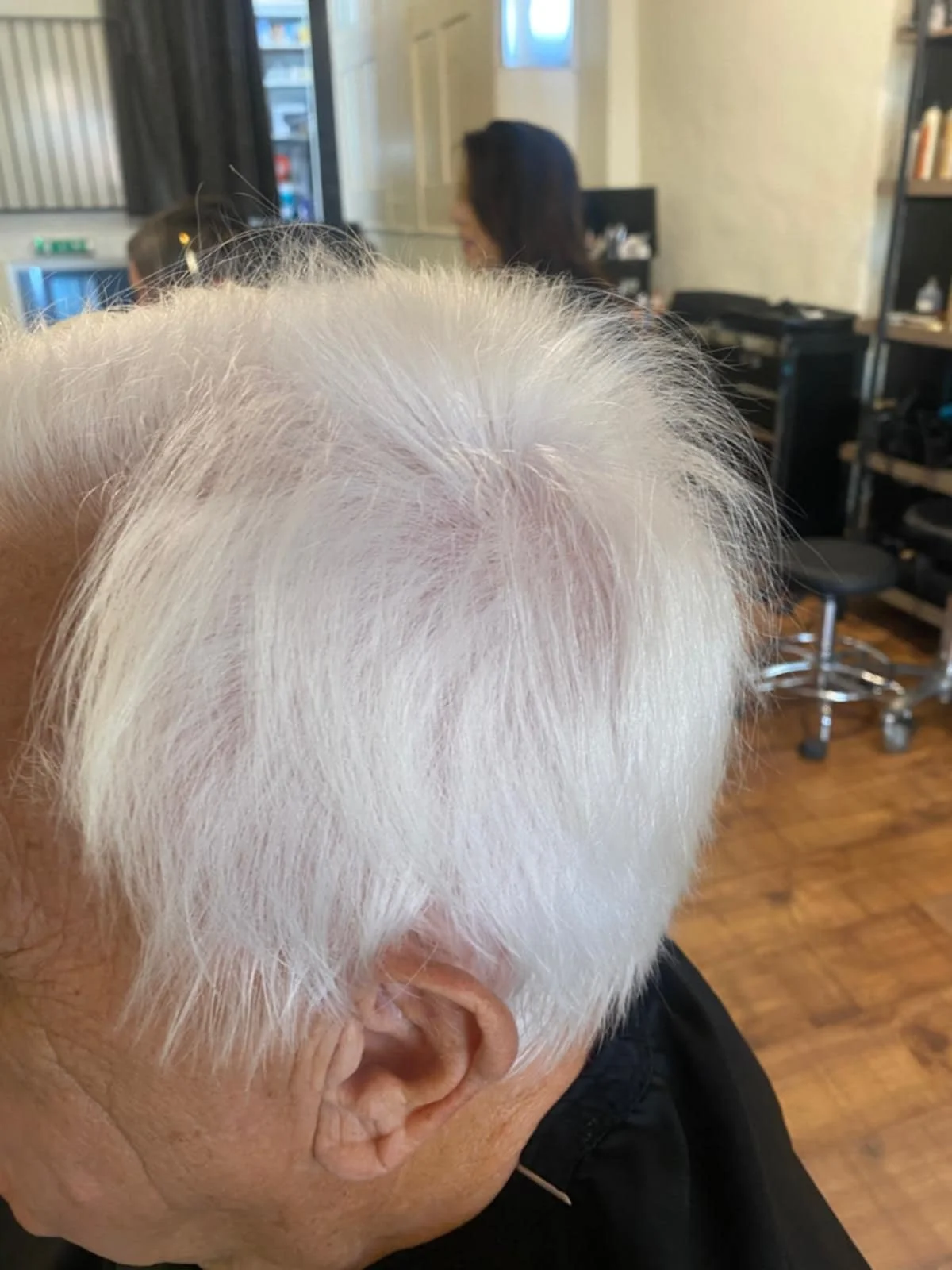 Hair Loss Case Study Saxmundham Wickham Market.jpeg