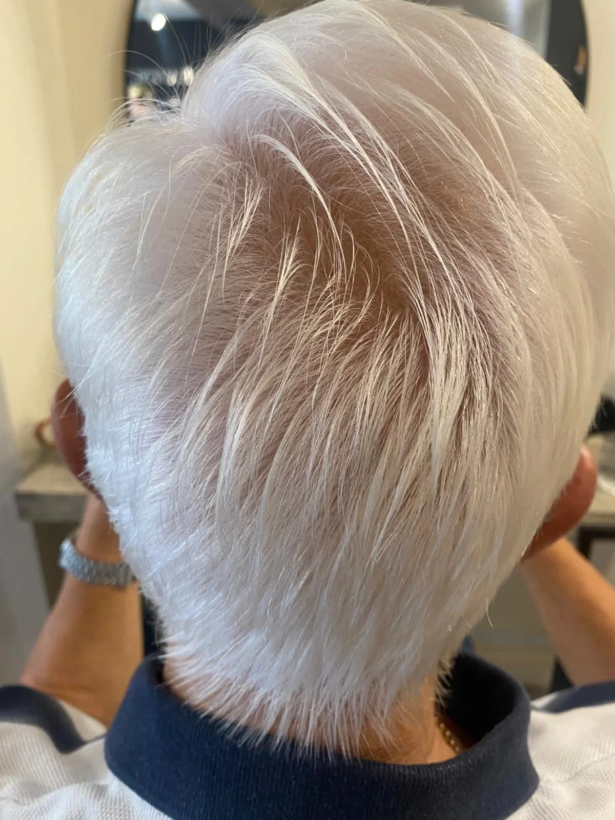 Hair Loss Restoration Saxmundham Wickham Market.jpeg