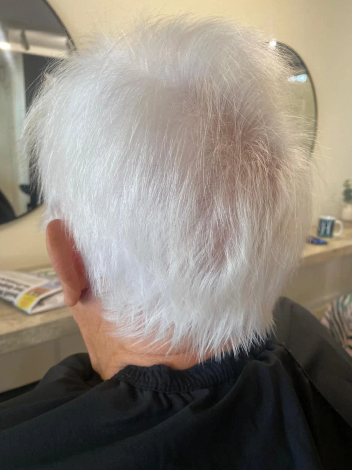 Hair Loss Transformation Saxmundham Wickham Market.jpeg