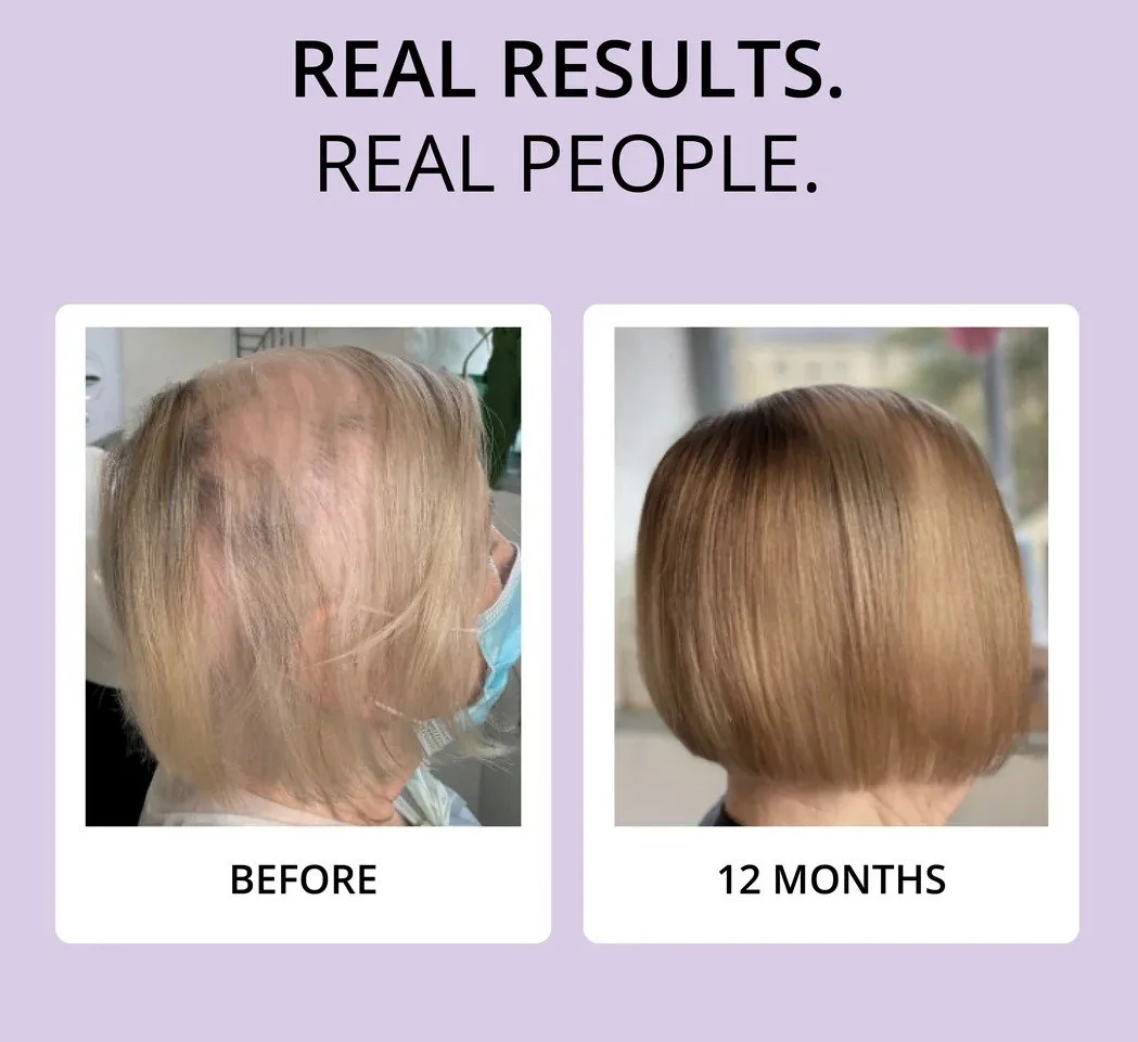 Glowwa Meno results 1.jpg