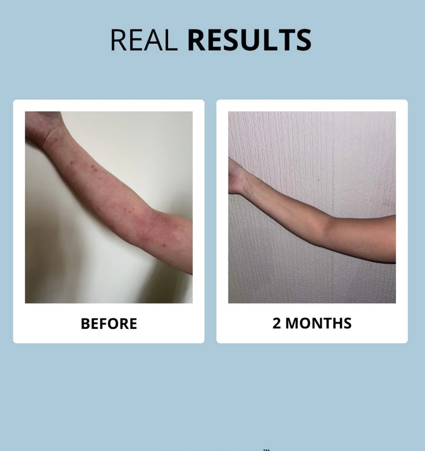 Glowwa Collagen results 1.jpeg