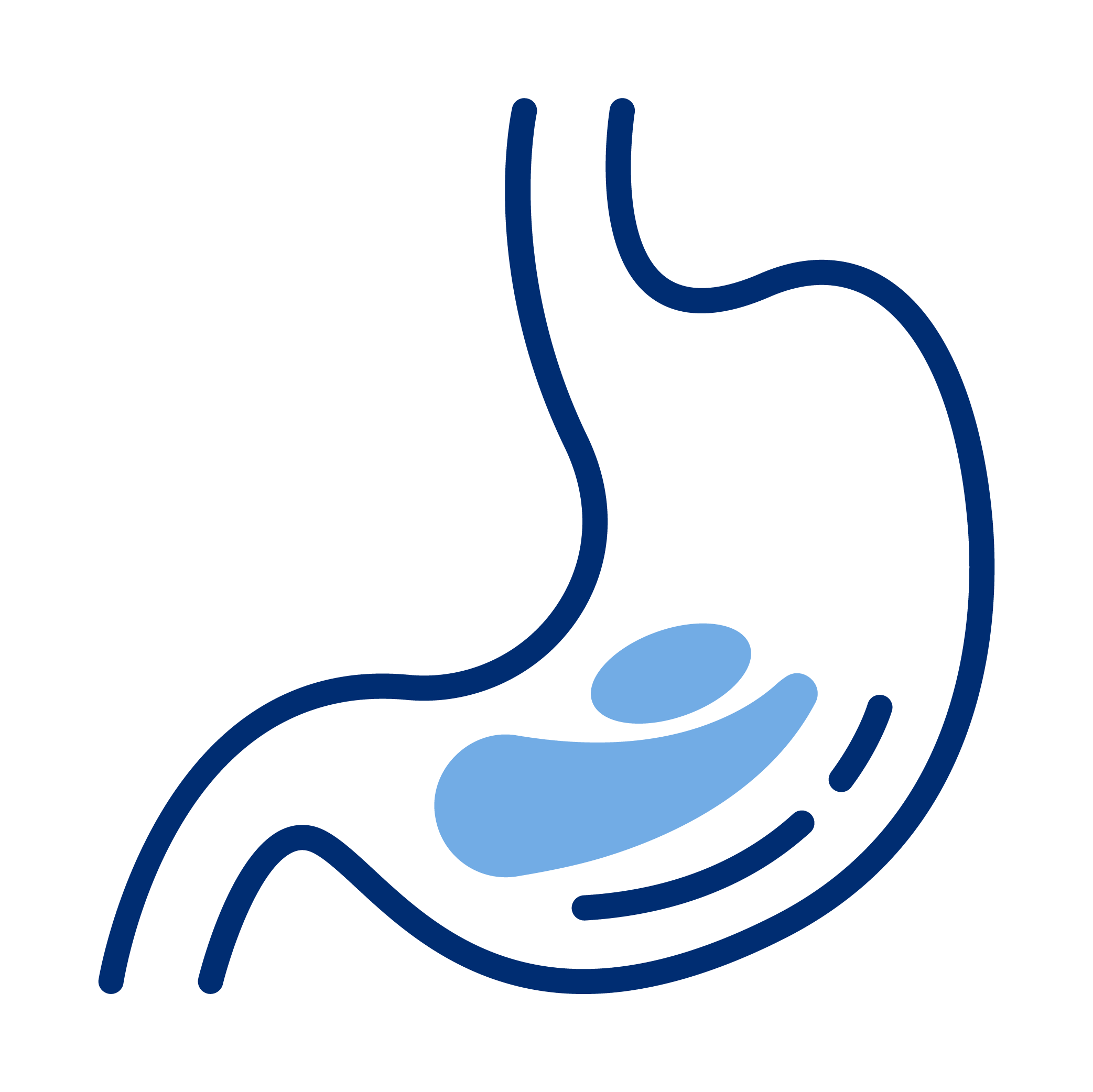 Outline illustration of a human stomach with a depiction of gastroesophageal reflux, showing acid moving from the stomach into the esophagus.
