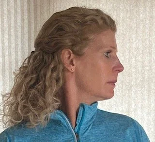 Cervical Rot. R..jpeg