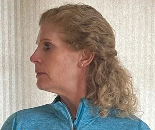 Cervical Rot. L..jpeg