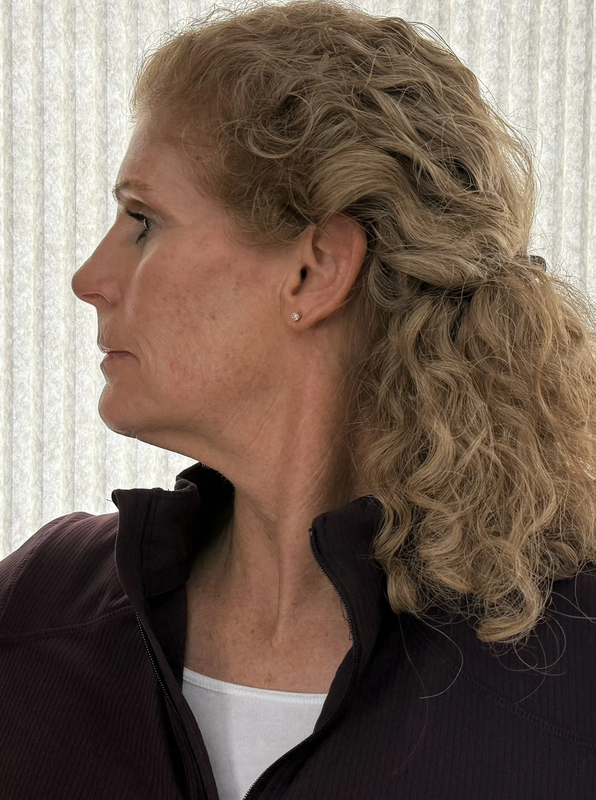 Cervical Rot. R Edited 2.JPG