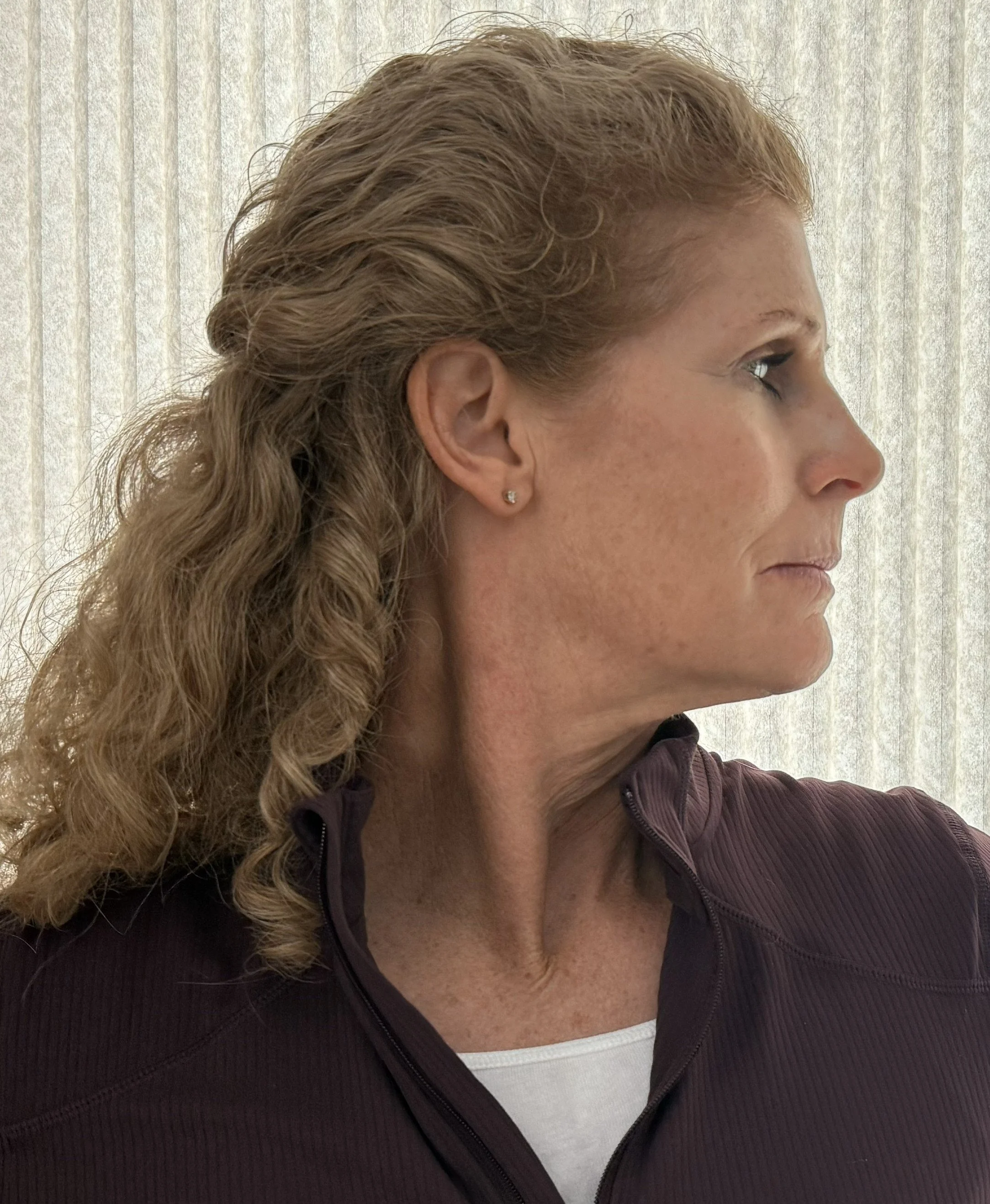 Cervical Rot. L Edited 3.JPG