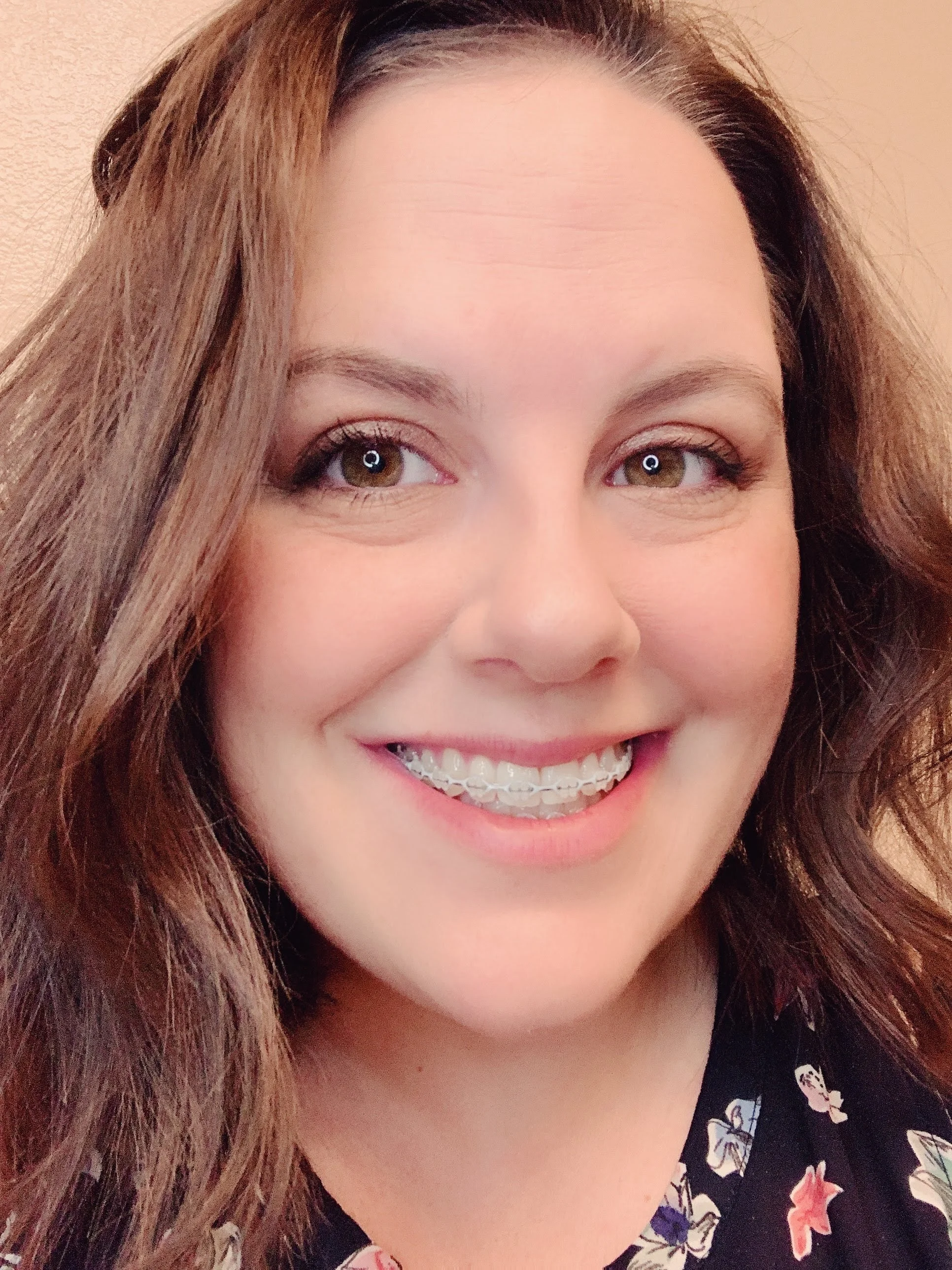 Close-up of a woman with brown hair, smiling, showing braces on her teeth, wearing a dark floral top, against a neutral background.