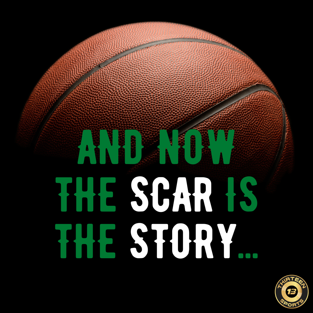 You Drew Stars Around The Scar -- And Now The Scar Is The Story