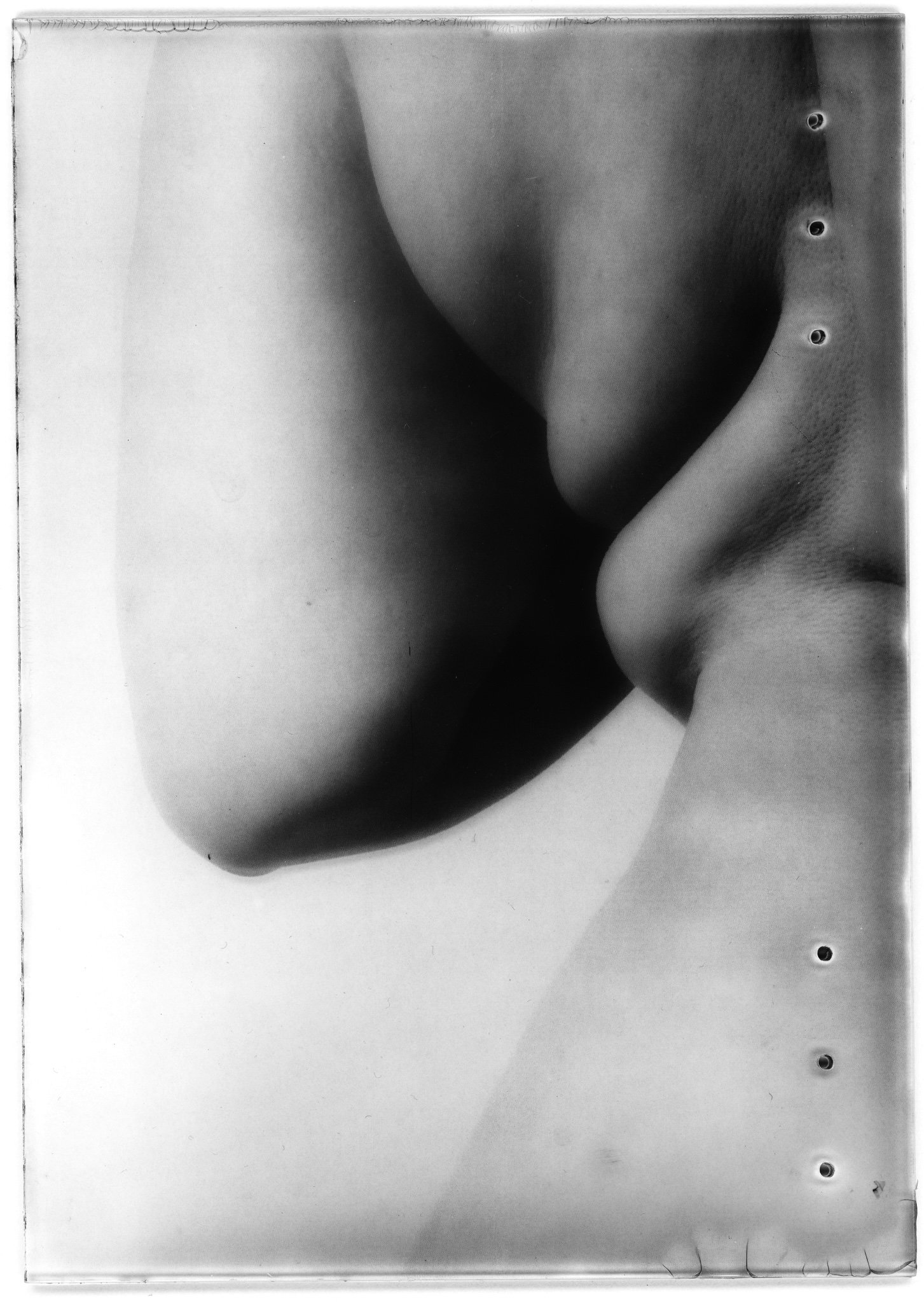 Anatomy of Flesh: Back Shoulder