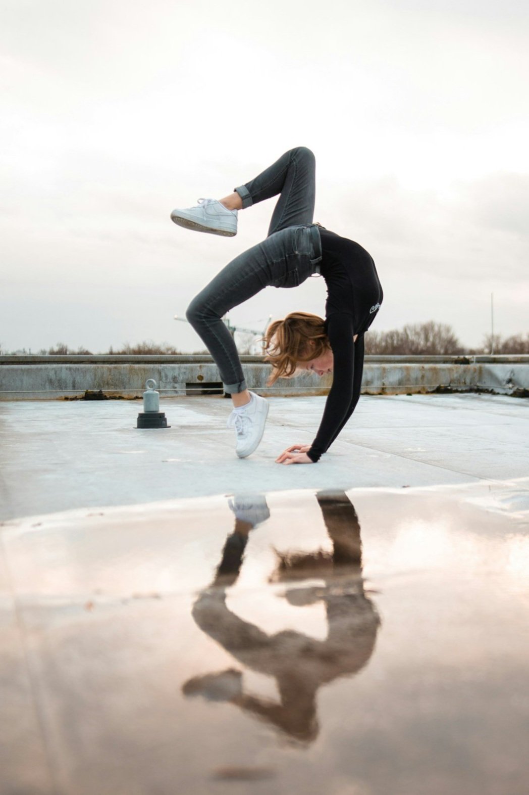 What Is Hypermobility — And Why It’s Often Missed