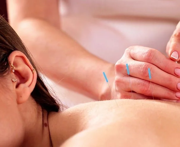 Common Reactions After Acupuncture Treatment