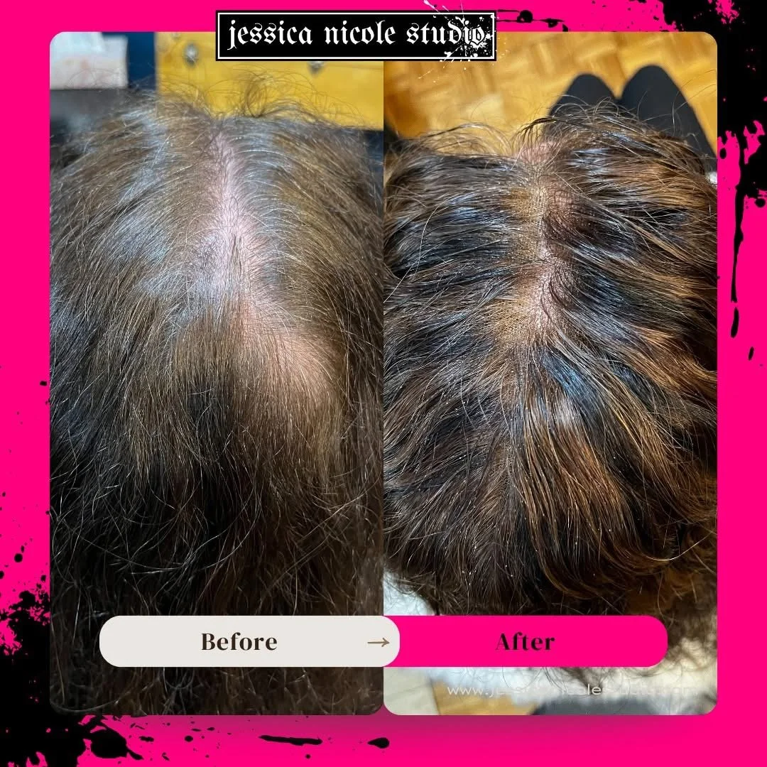 Before-and-after close-up of thinning hair at the crown, showing increased hair coverage after treatment.