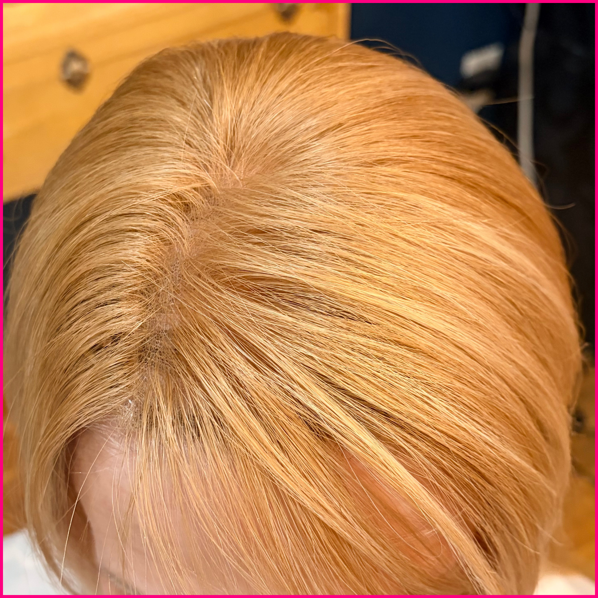 Close-up of a person’s strawberry-blonde hair showing the scalp and hair part