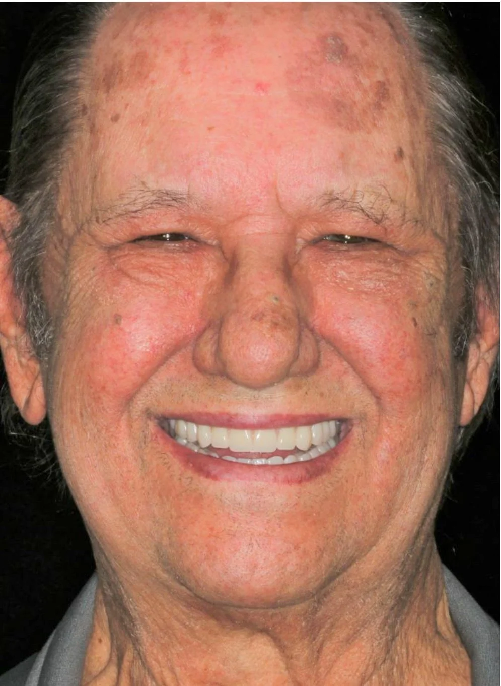 AFTER 2 AND DENTAL IMPLANTS ON SERVICES PAGE.jpg