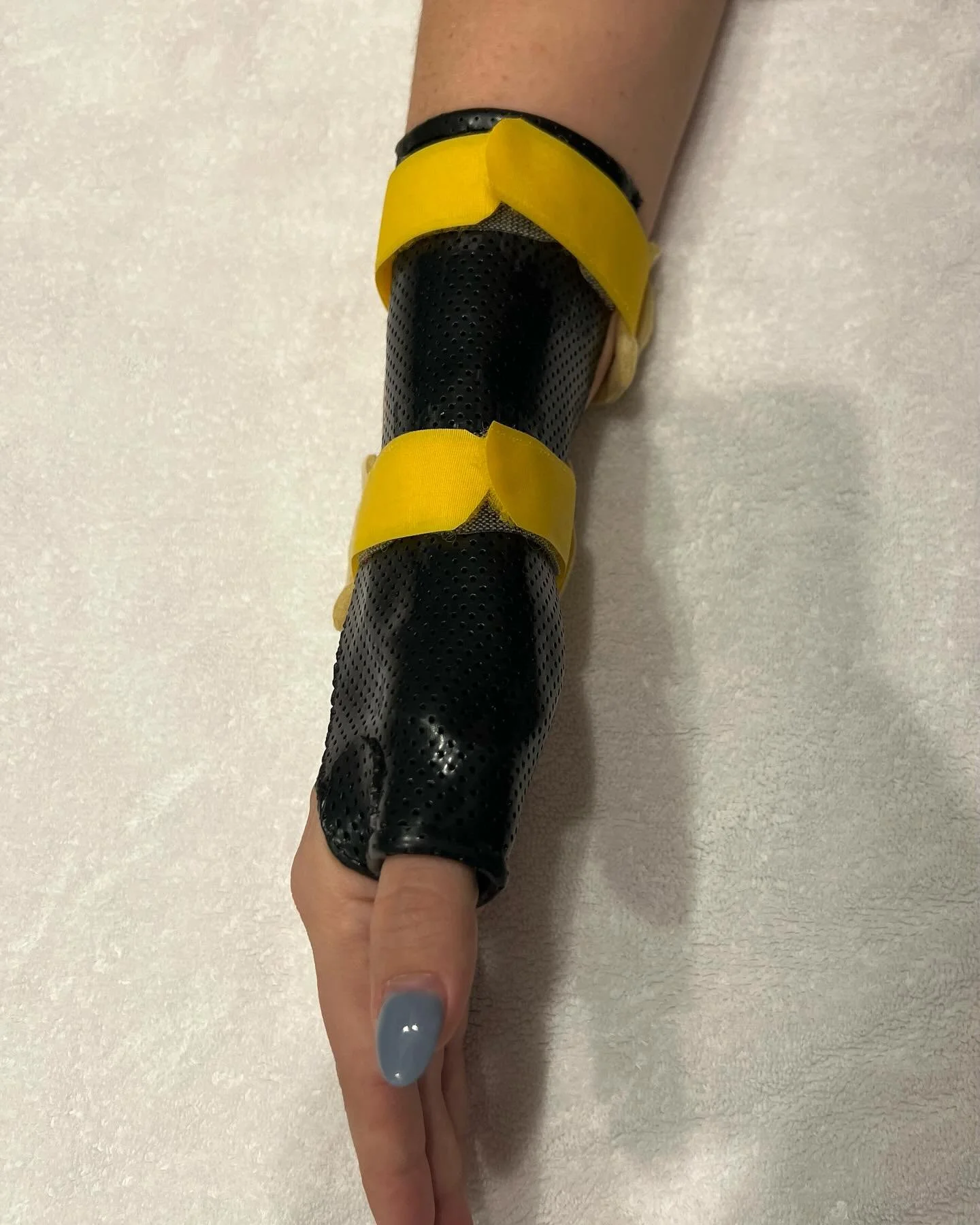 This patient presents with pain over the radial aspect of their thumb and wrist. De Quervain&rsquo;s Tenosynovitis, sometimes known as &ldquo;Mommy Thumb&rdquo; can occur with new mothers. 

Repetitive motions such a as holding, lifting, feeding, and