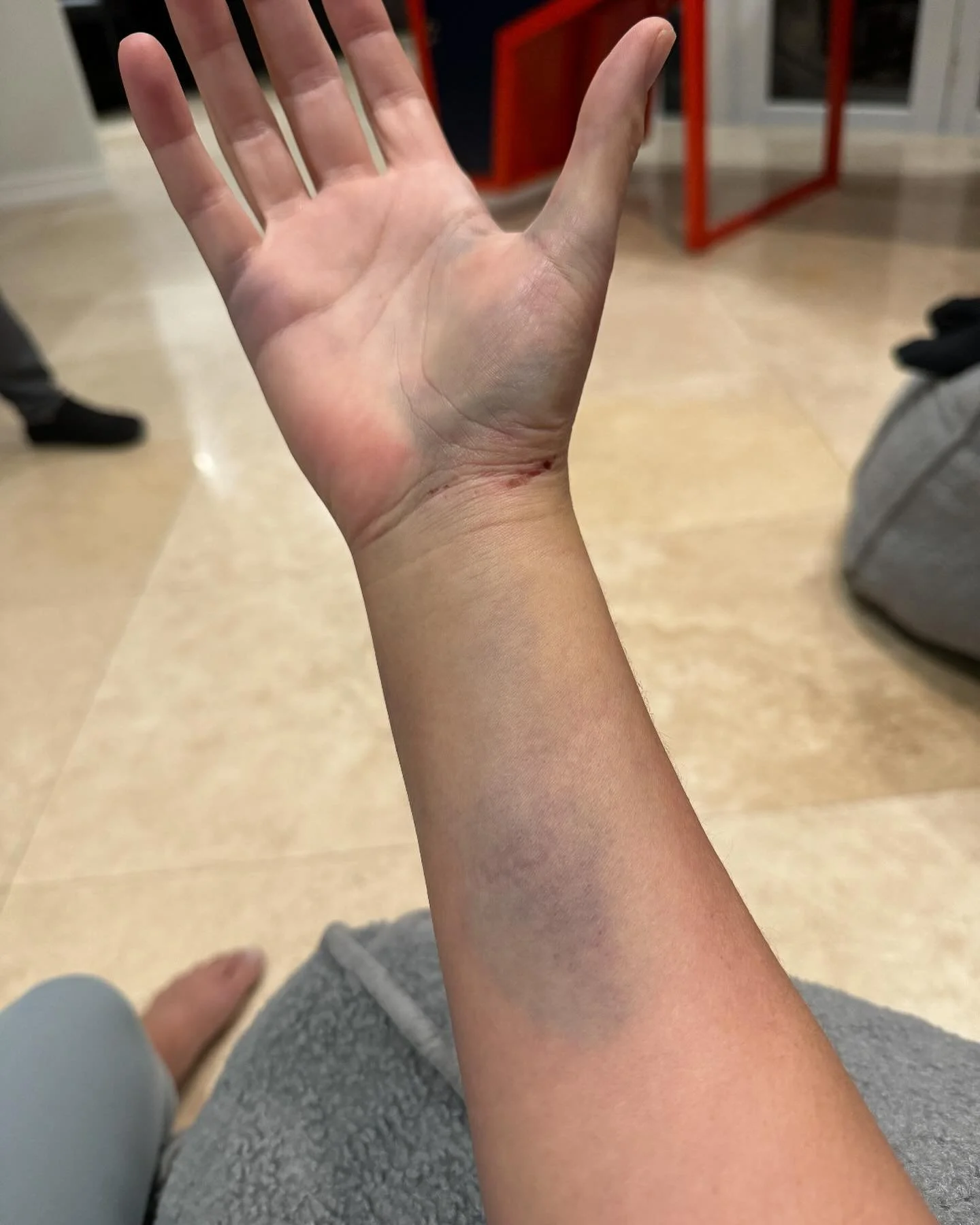 When your big sister gets hurt, the house call is a must. No broken bones thankfully, so time to get her back on track. She requested hot pink straps so of course I had to deliver 🔥. It&rsquo;s never easy to work with siblings so let&rsquo;s wait an