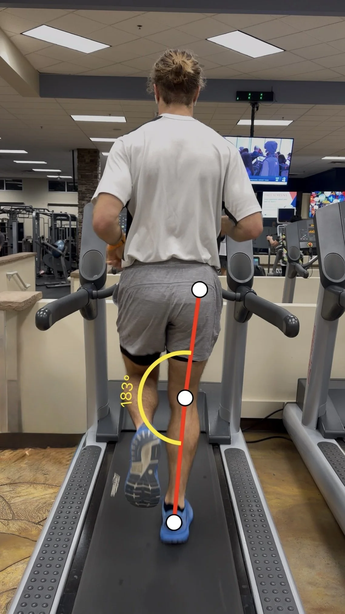 Gait Analysis Pic- Knee Alignment .jpg