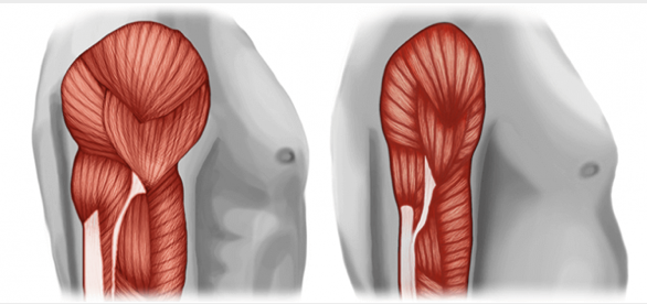 Muscle Loss Explained: Why It Happens and How to Slow It Down