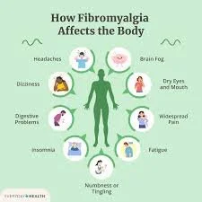How Manual Lymphatic Drainage Can Help Fibromyalgia