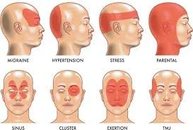 Manual Lymphatic Drainage for Migraine Relief