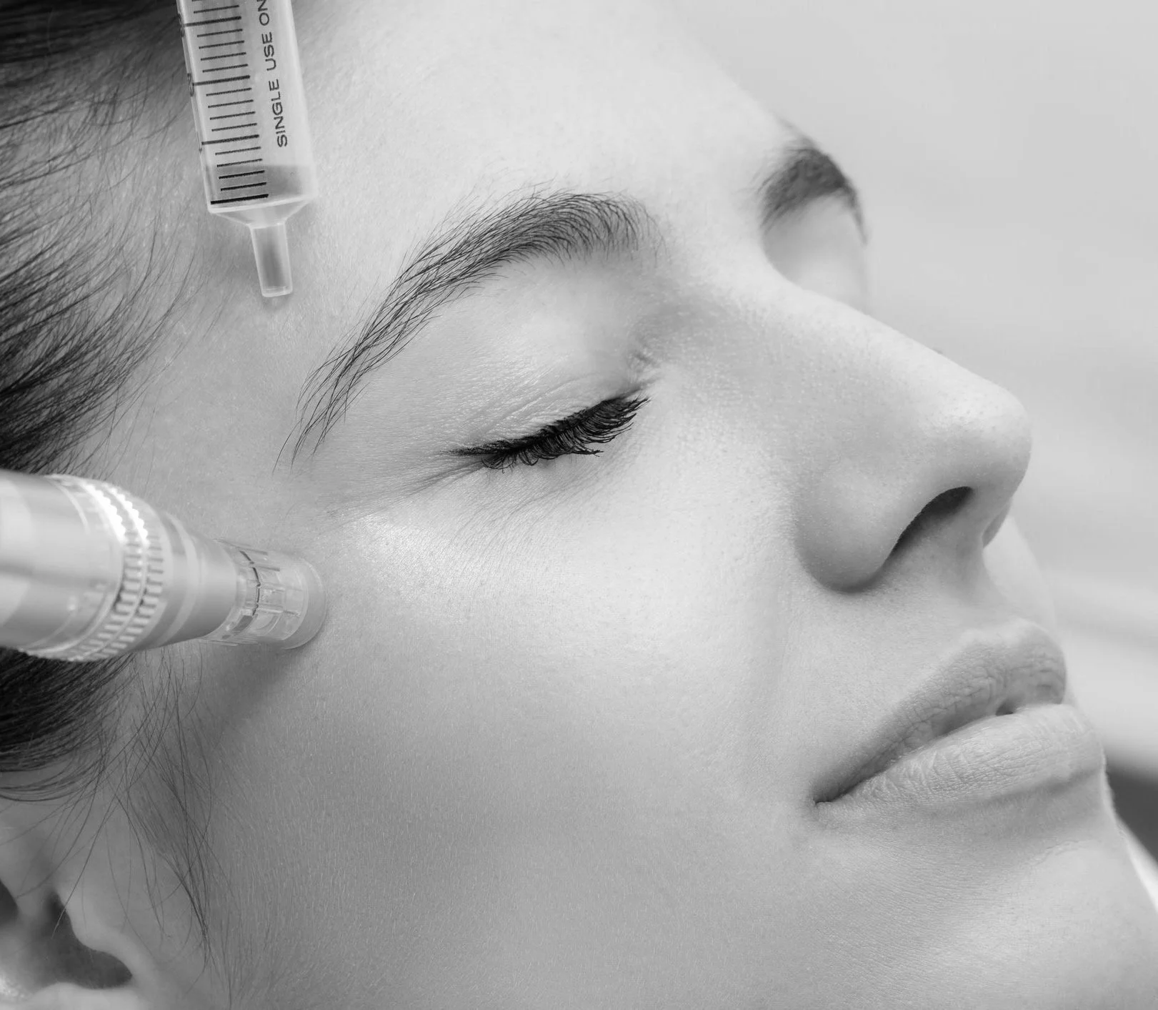 Arthrex® PRP for Skin Rejuvenation