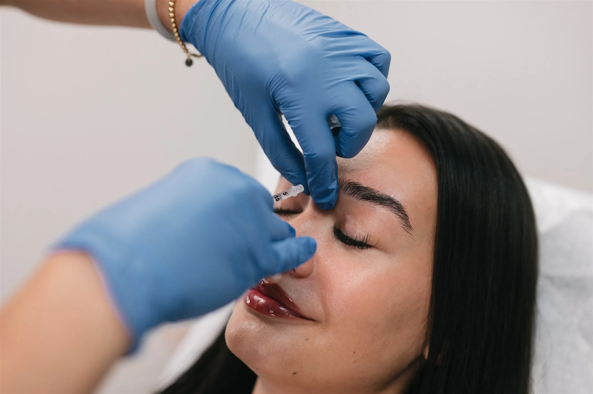 A woman receiving a cosmetic injection in her nose by a medical professional wearing blue gloves.