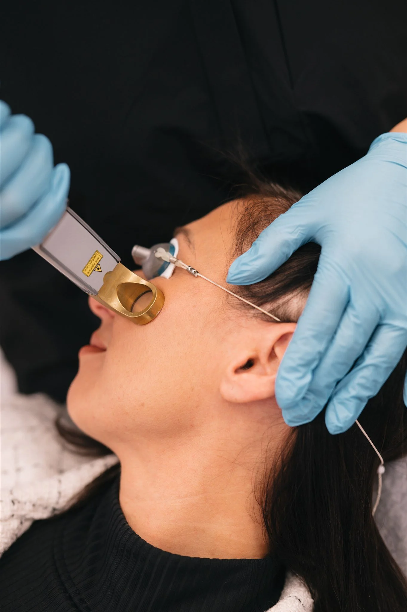 Close-up of a woman receiving a laser treatment on her forehead, with a technician wearing blue gloves holding the device during the procedure.