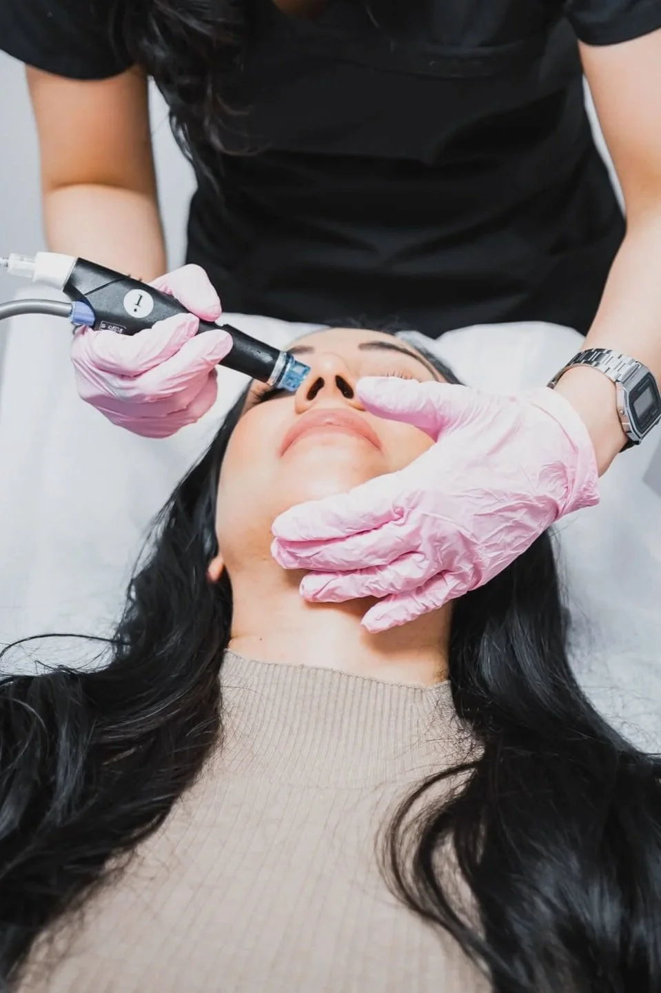 HydraFacial Laser Sheer Edmonton
