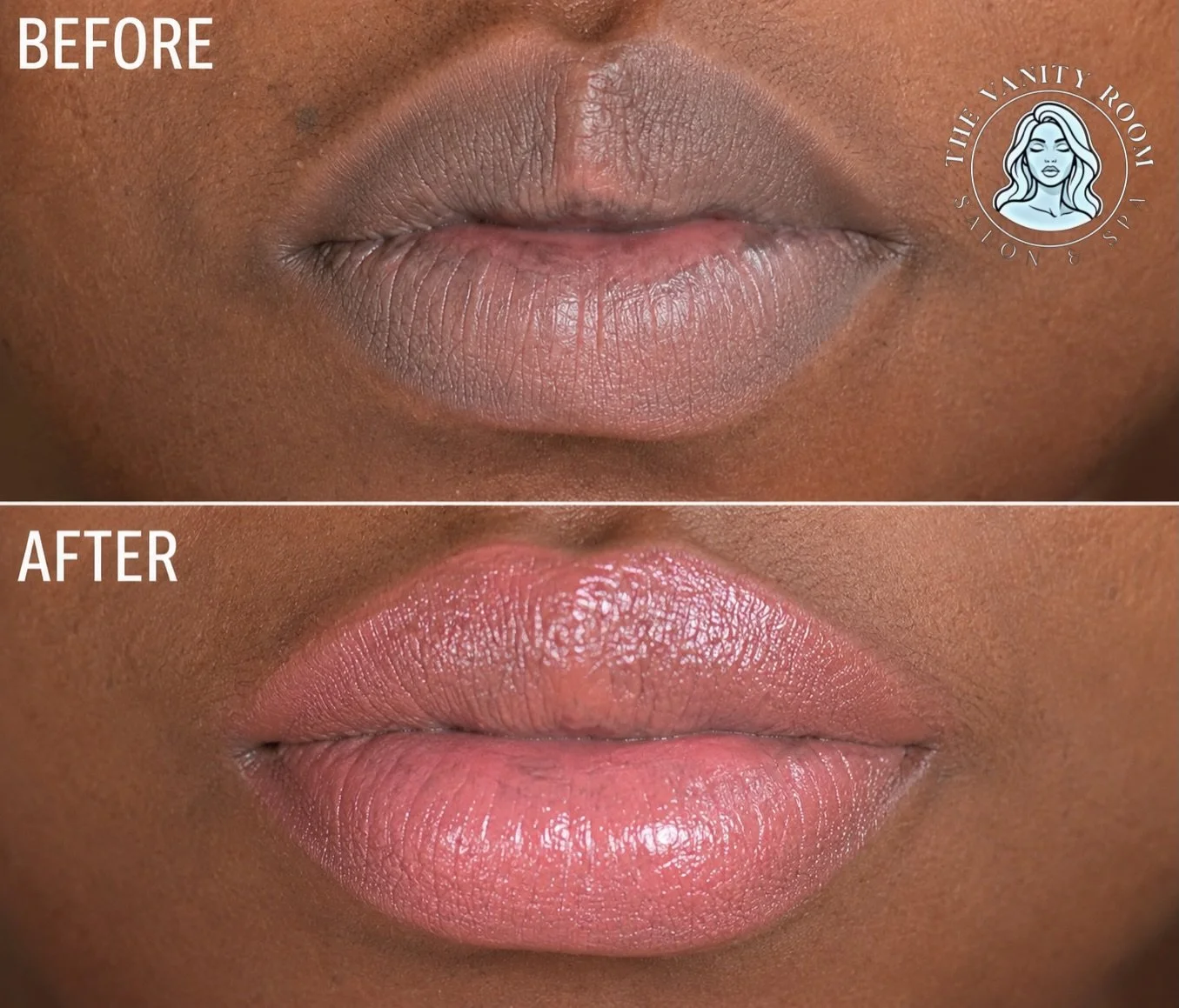 LIP BLUSH TATTOO is a procedure in which trust is imperative. You will not see results right away. This client for example, requires a lip neutralization prior to implanting the chosen pigment. She may require a touchup session in 6-8 weeks but it is
