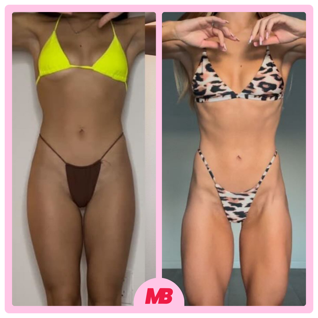 Side-by-side photos of a woman with a toned physique; in the left photo, she wears a neon yellow bikini top and a brown thong, and in the right photo, she wears a leopard print bikini top and matching bottom, both with her hands near her face.