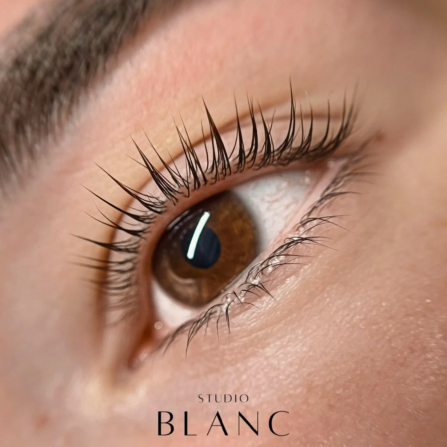 🚨𝑵𝑬𝑾 𝑻𝑹𝑬𝑨𝑻𝑴𝑬𝑵𝑻 𝑪𝑶𝑴𝑰𝑵𝑮 𝑺𝑶𝑶𝑵🚨

sometime in September, I&rsquo;ll be announcing a new treatment 🤭 it&rsquo;s been on the market for some time now and I&rsquo;m so excited to introduce it in the treatment room. y&rsquo;all are go