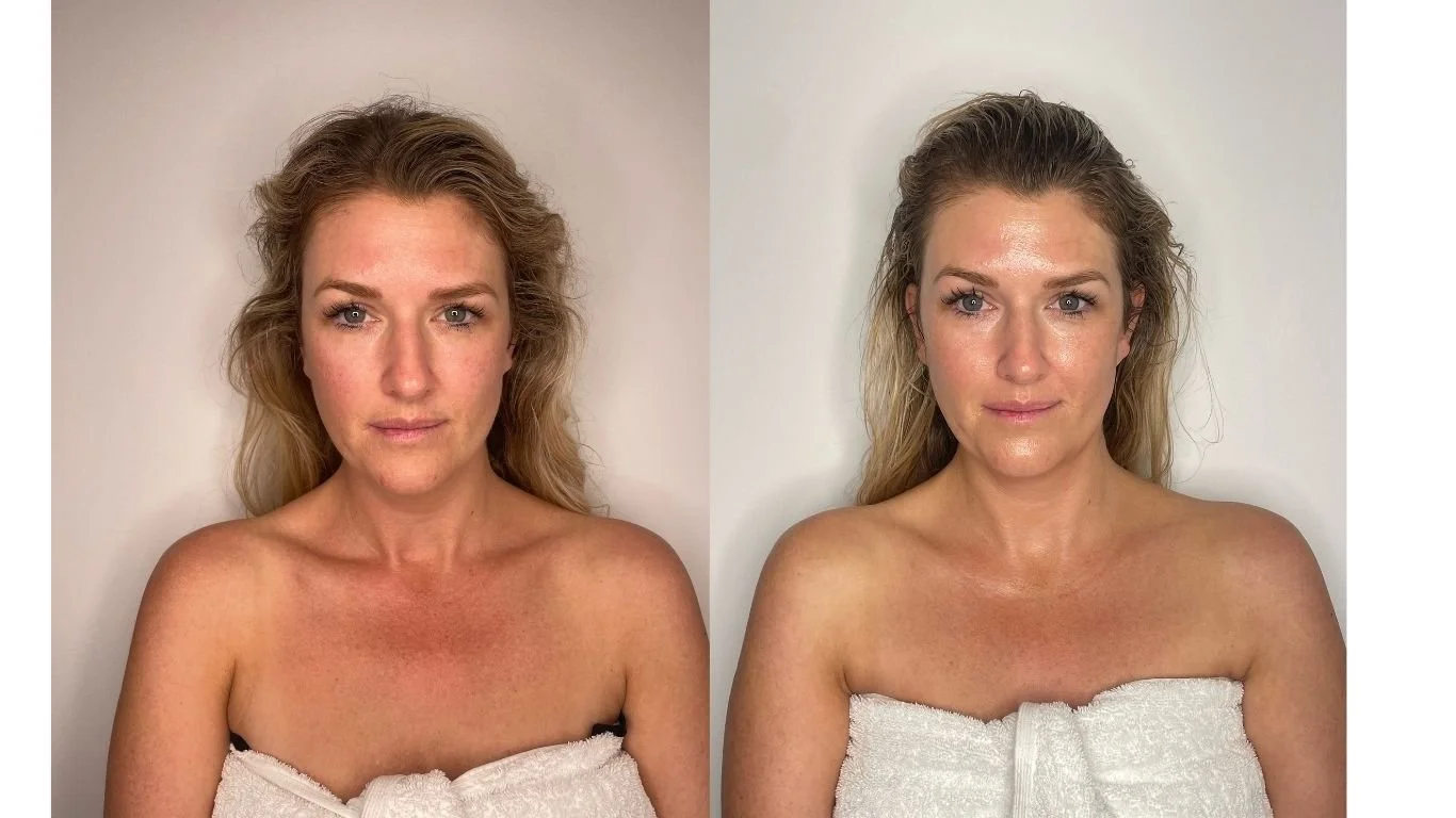 Before and After of Facelift Facial at Sienna Cary East Fremantle Salon 