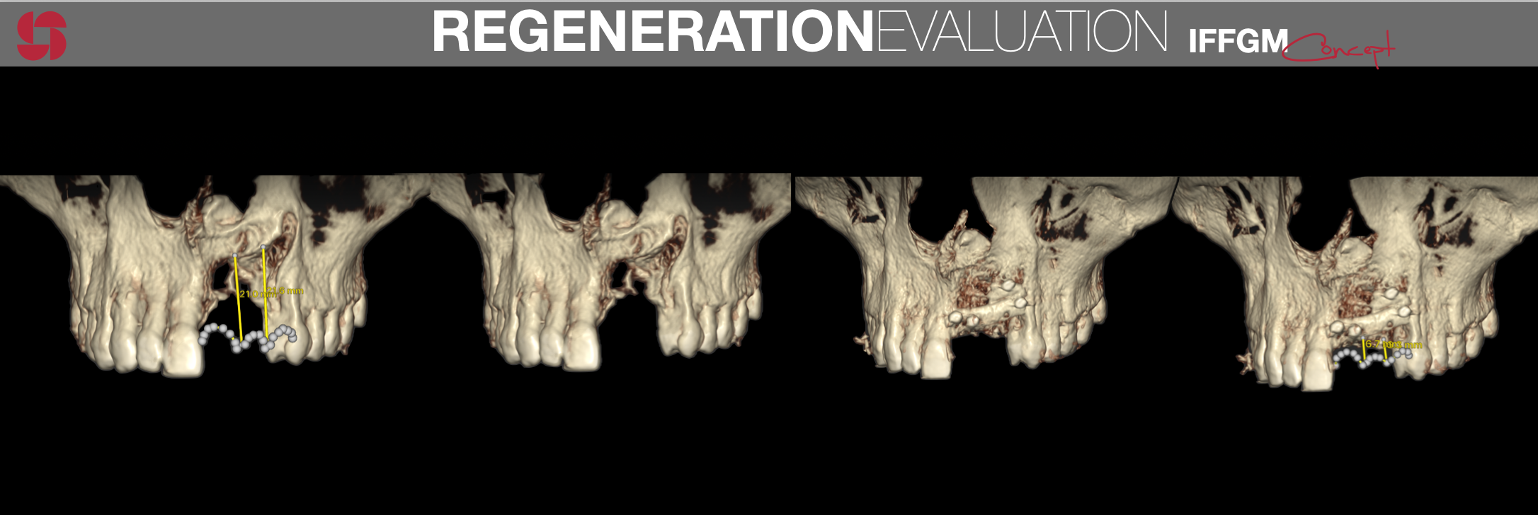 Regeneration evalutation IFFGM.png