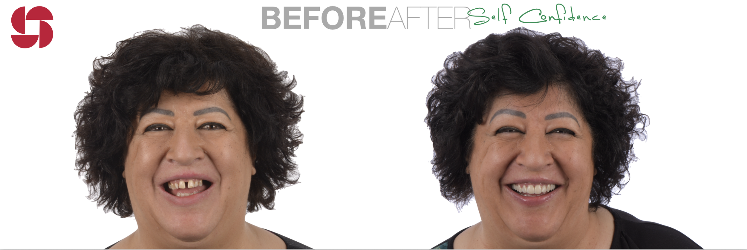 Before - After Self Confidence.png