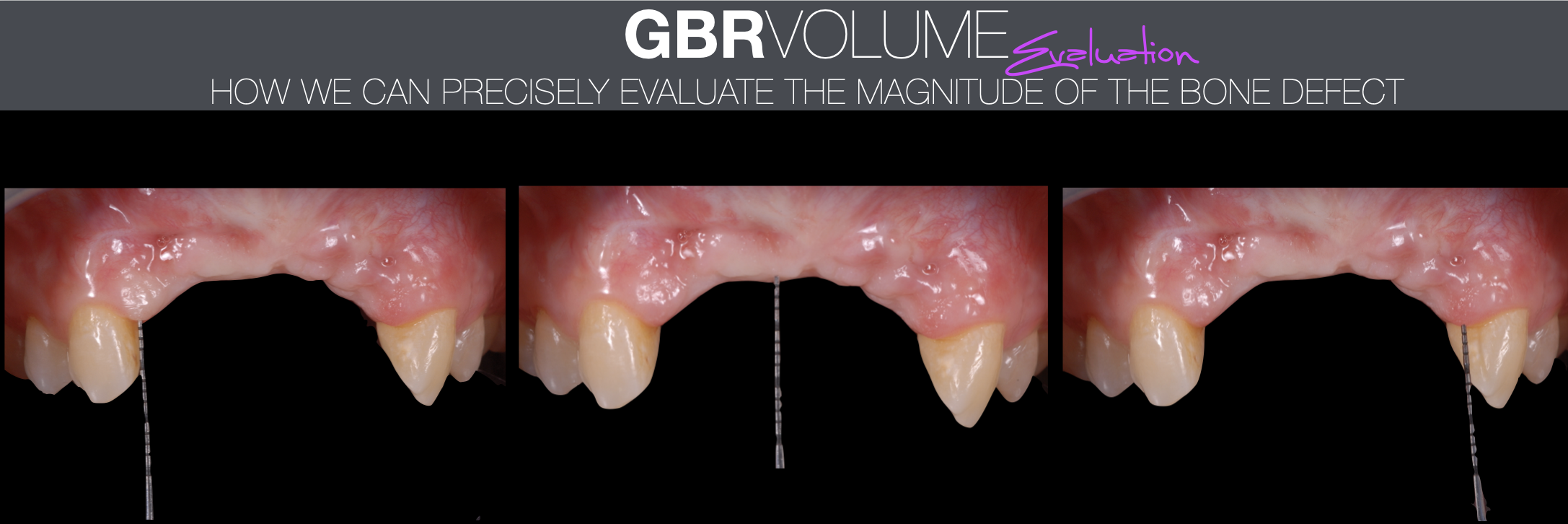 GBR Volume Evaluation.png