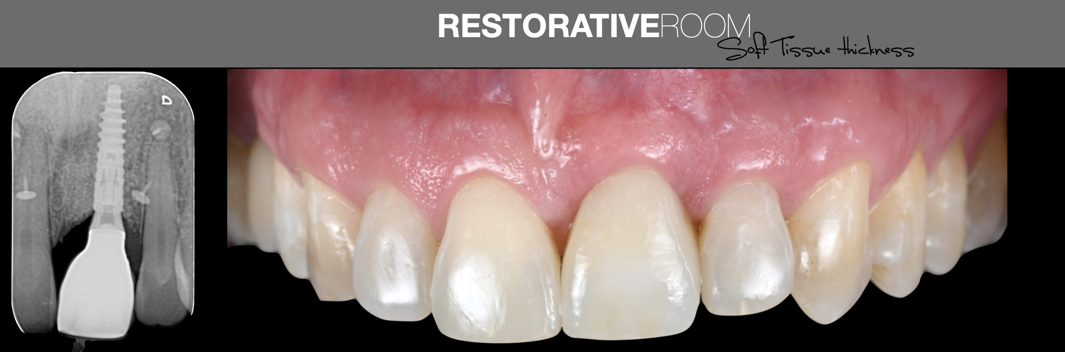 Restorative room.png