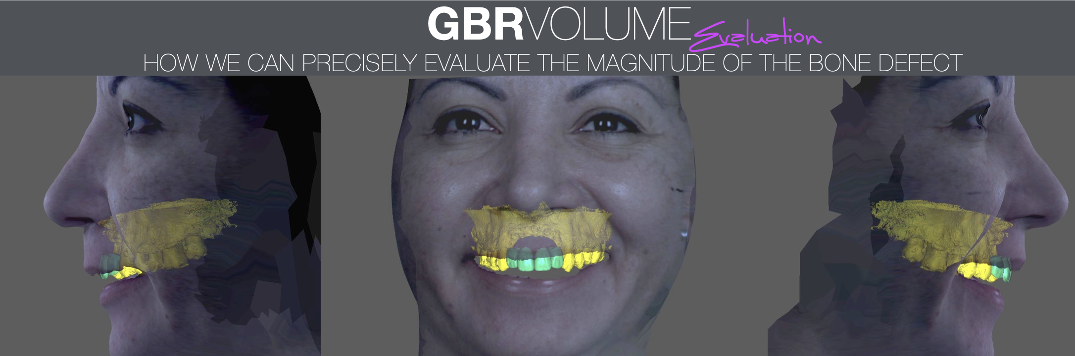 GBR Volume Evaluation 2.png