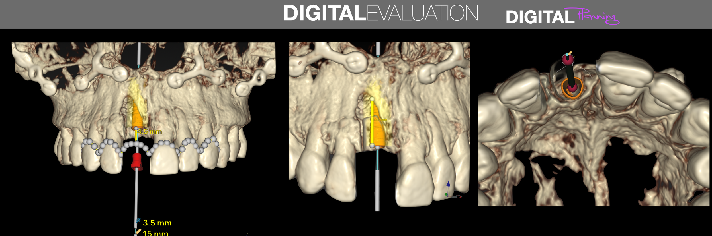 Digital Evaluation.png
