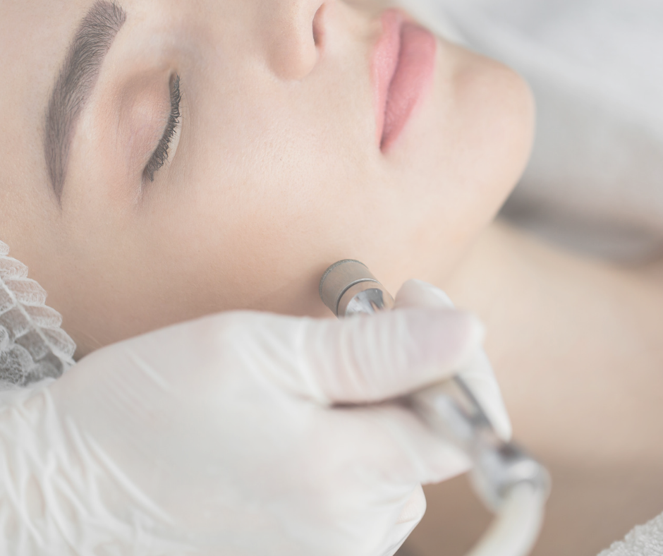 Microdermabrasion Perth
