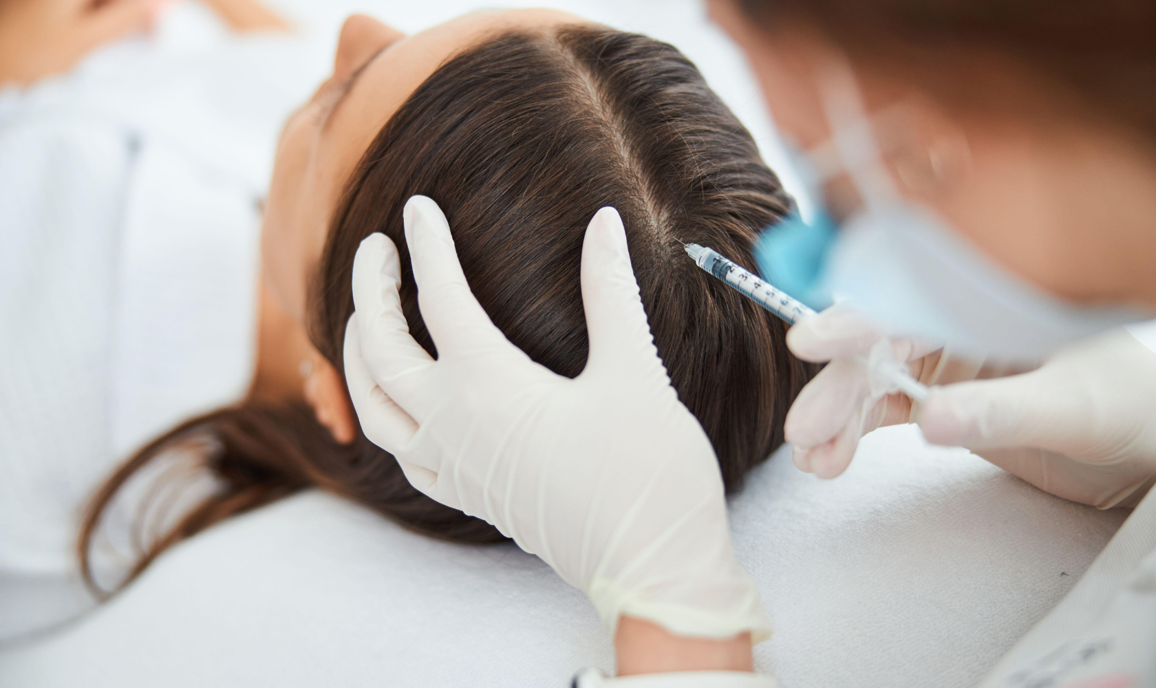 PRP Hair Restoration in Sthetika Burbank, CA, 91502