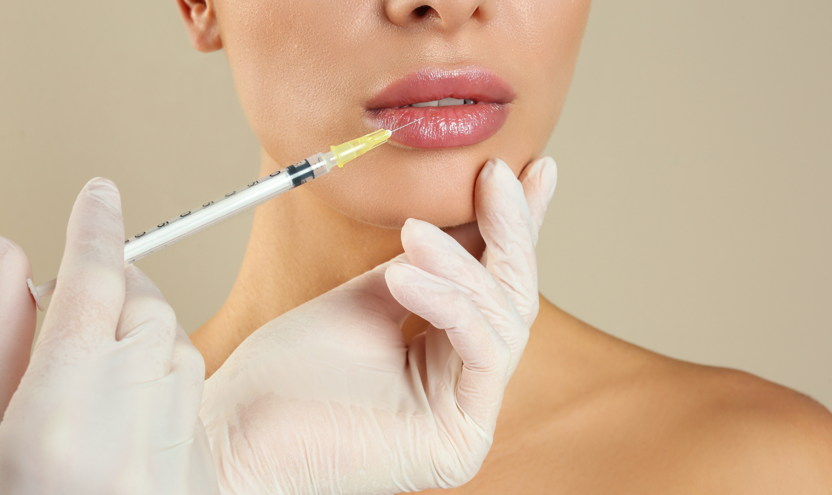 Dermal Fillers in Sthetika Burbank, CA, 91502