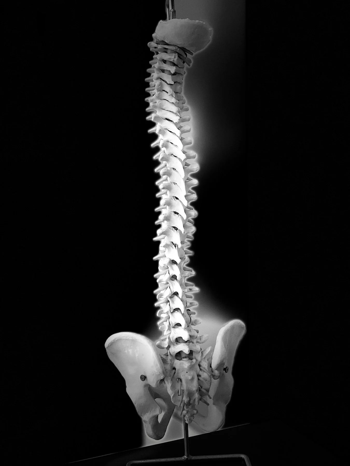 A black and white human skeleton model showing the spine and pelvis, mounted on a stand.